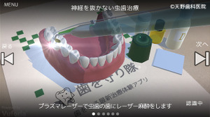 AR動画で最新歯科治療を体験　現役歯科医が製作したARアプリ『歯を守り隊』がリリース 画像