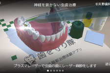 AR動画で最新歯科治療を体験　現役歯科医が製作したARアプリ『歯を守り隊』がリリース 画像